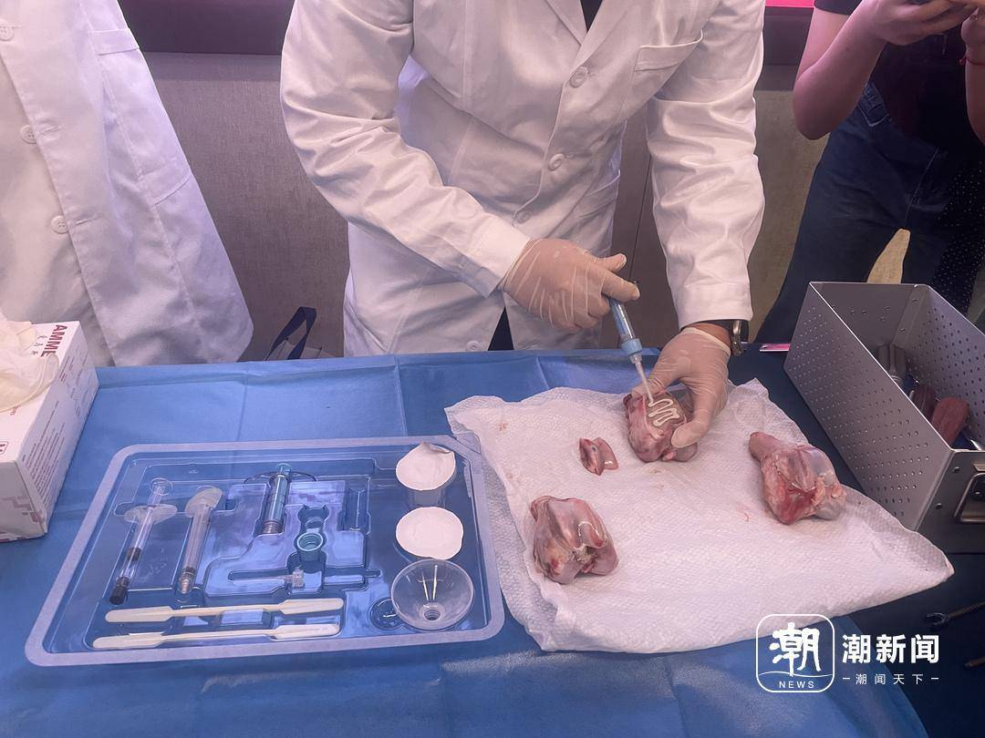 浙江团队成功研发全球首款“骨胶水”!粉碎的骨头一粘就好,未来有望一针治愈骨折